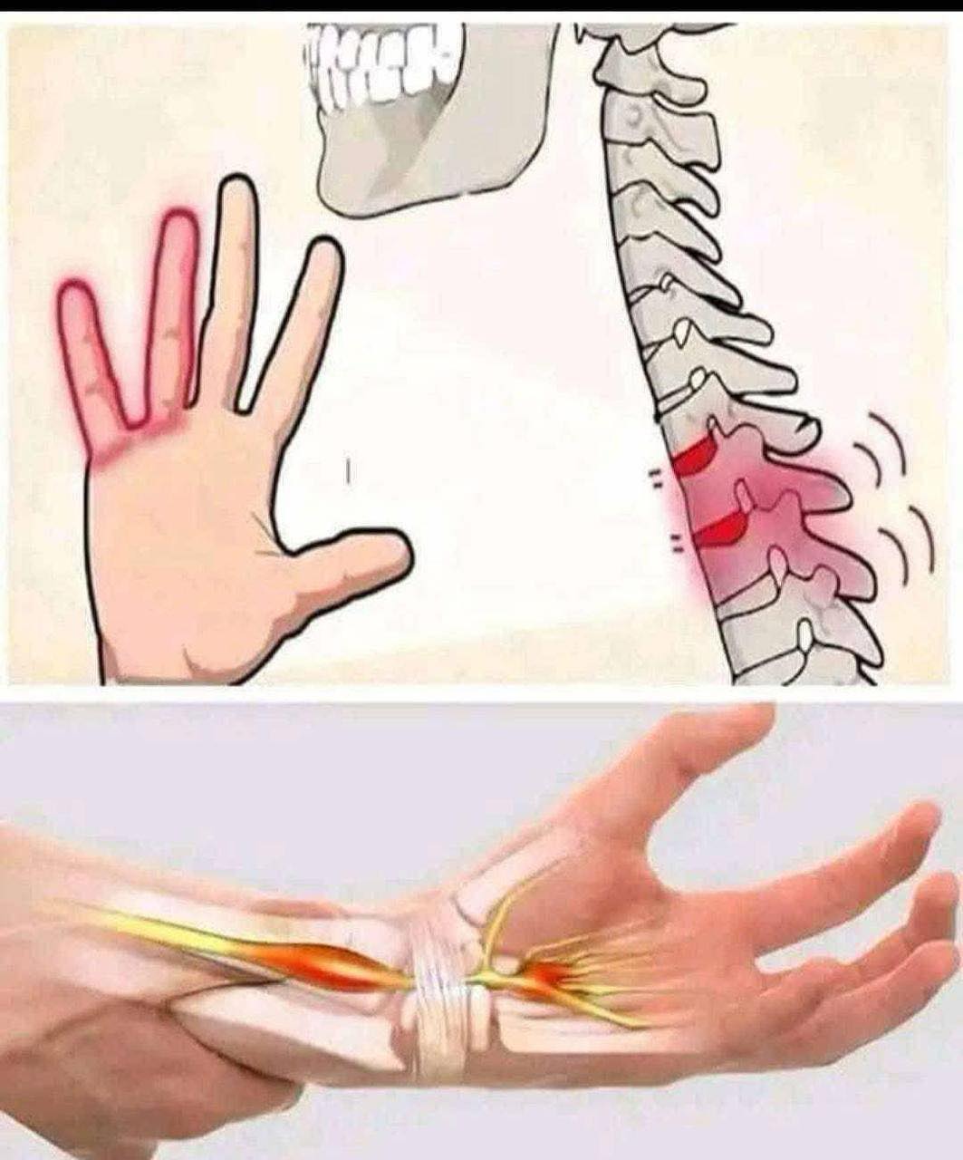 Reasons You Could Have Numbness or Tingling Sensations in Your Hands